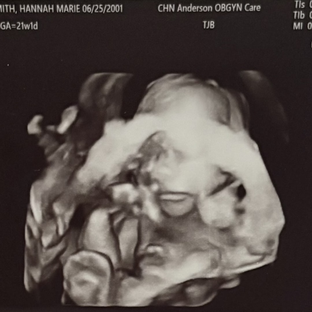 Photo shared by Hannah for their Babylist baby registry.