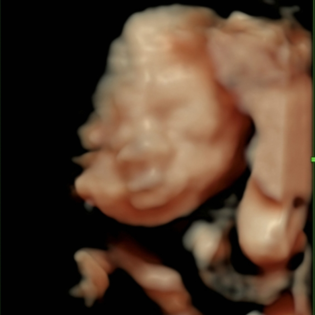 Photo shared by Rose & JD for their Babylist baby registry.