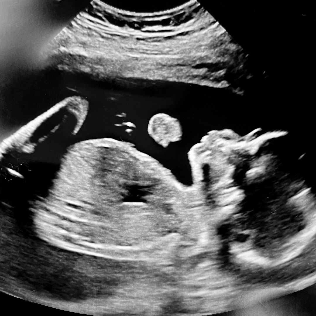 Photo shared by Kiersten for their Babylist baby registry.