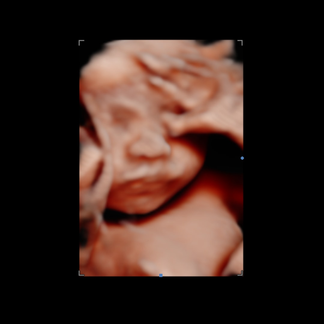 Photo shared by Grace for their Babylist baby registry.