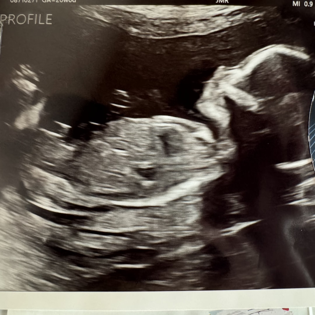 Photo shared by Casarah for their Babylist baby registry.
