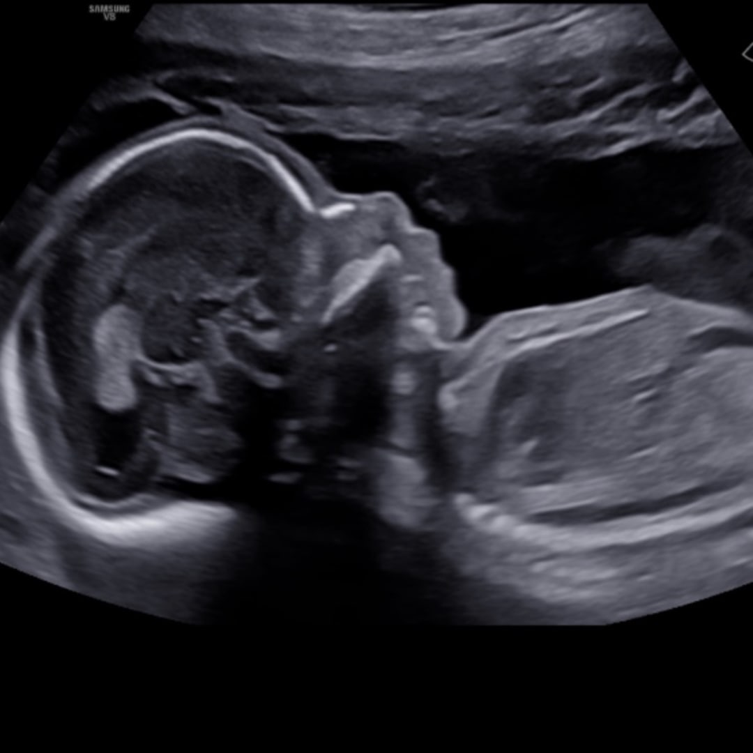 Photo shared by Domenique for their Babylist baby registry.
