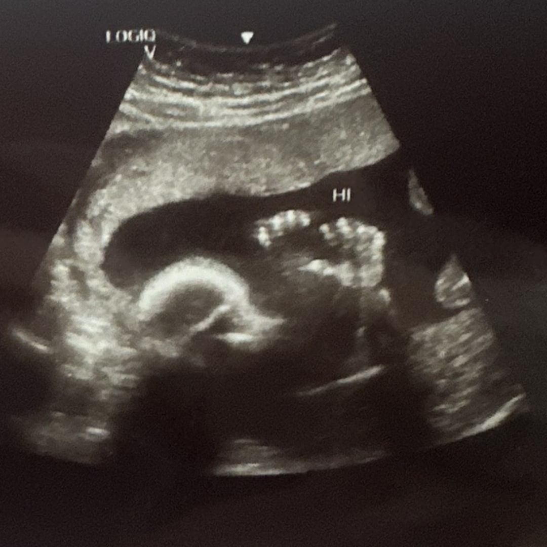 Photo shared by Hannah for their Babylist baby registry.