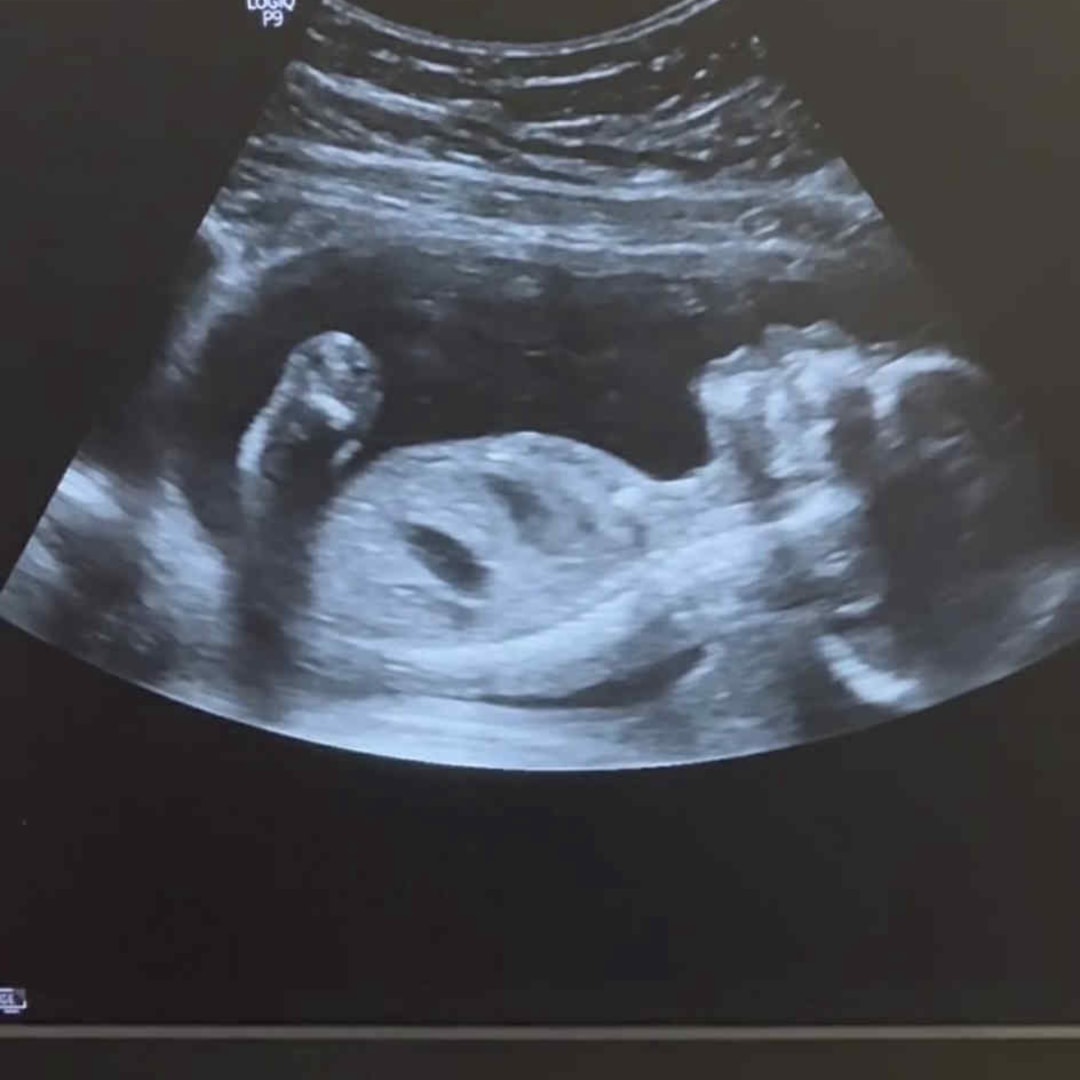 Photo shared by Alehly for their Babylist baby registry.