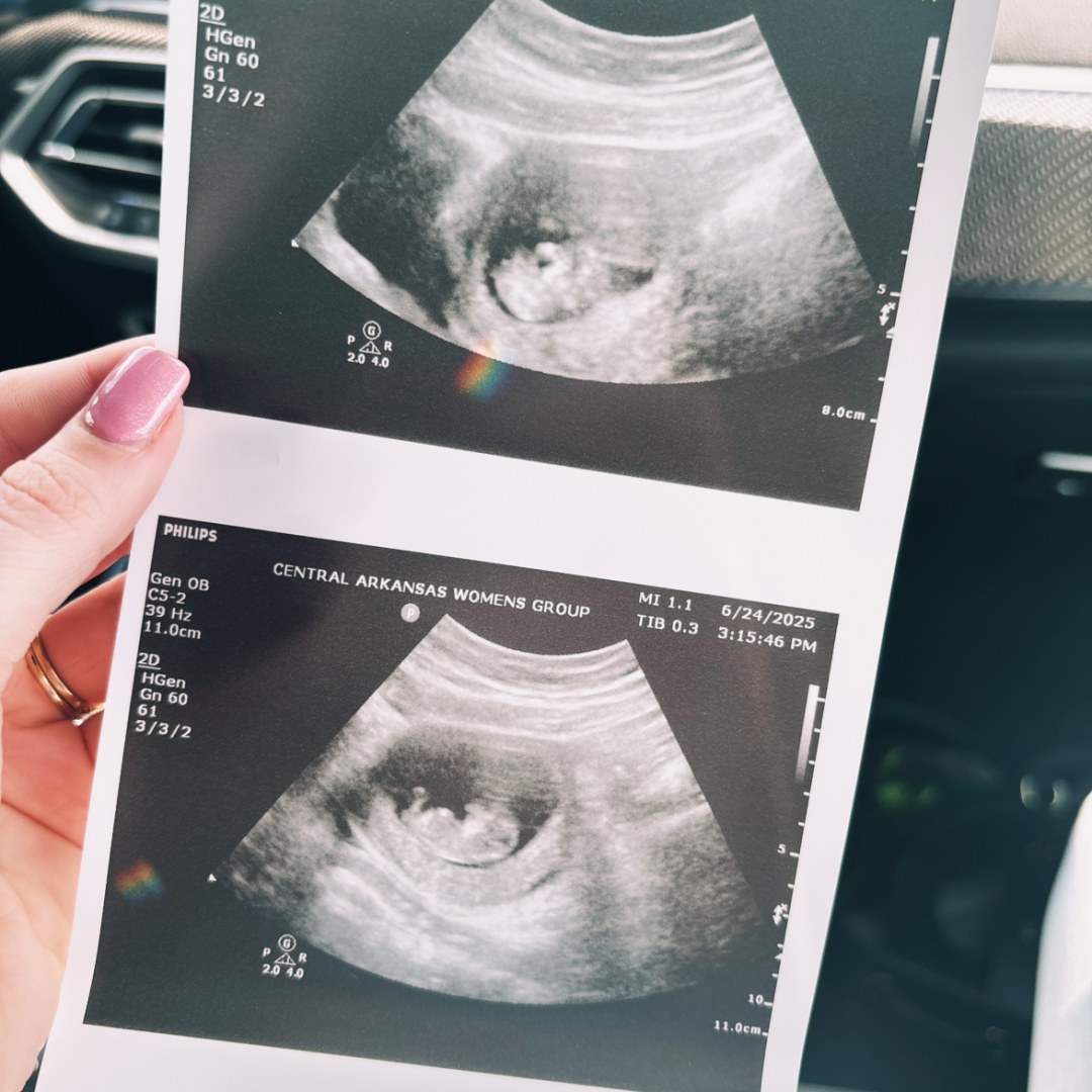 Photo shared by Allie for their Babylist baby registry.