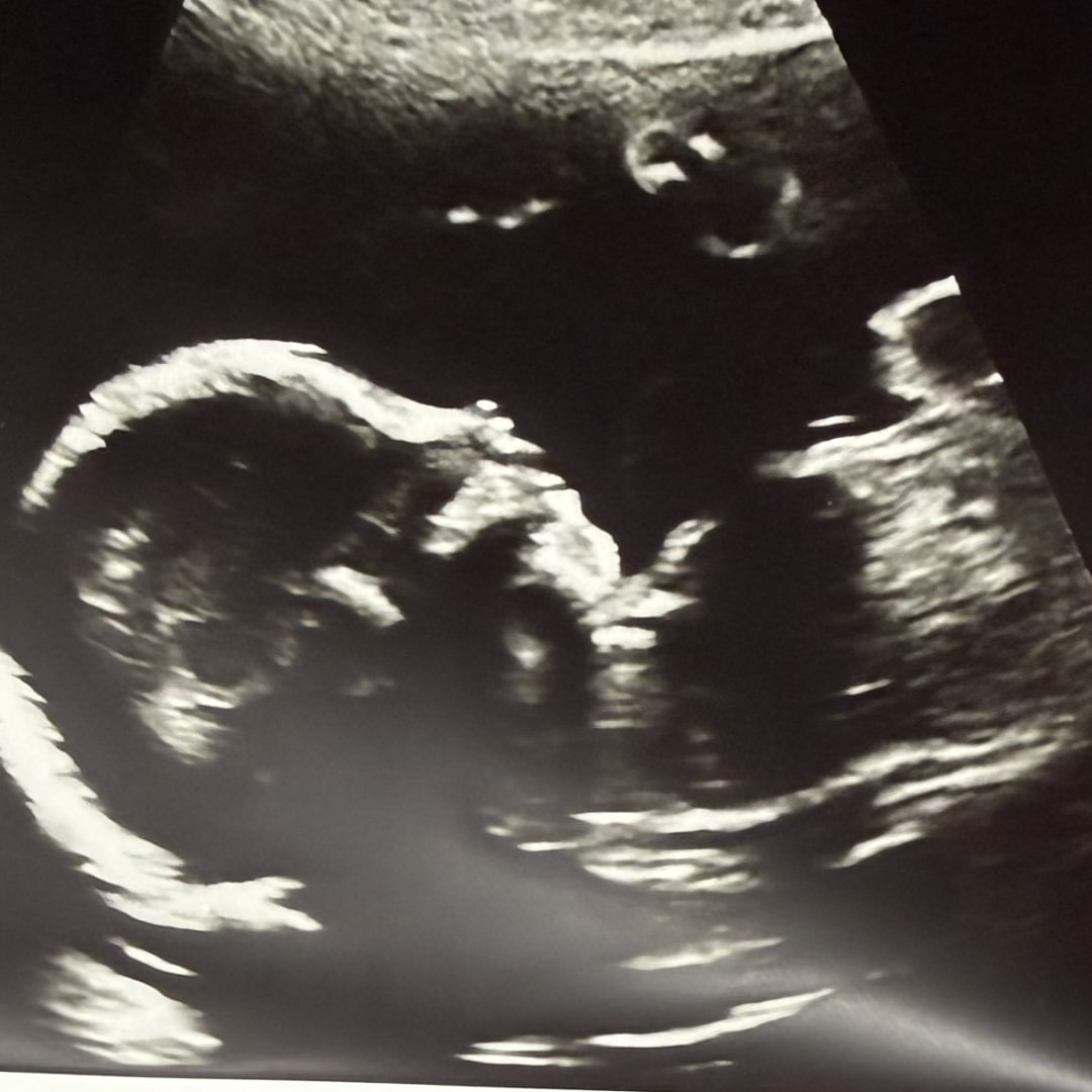 Photo shared by Alexandra for their Babylist baby registry.