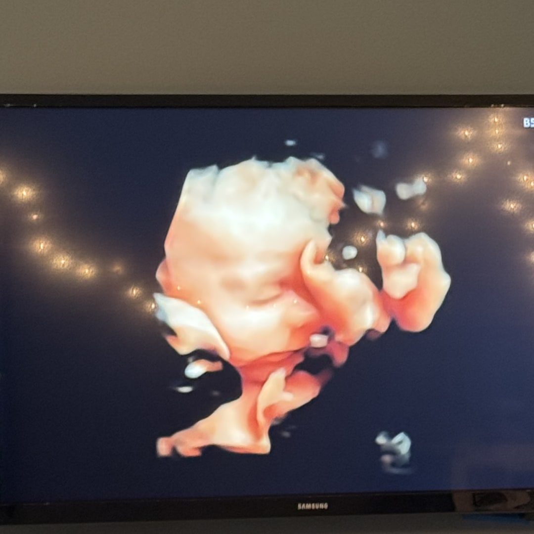 Photo shared by Oakley for their Babylist baby registry.