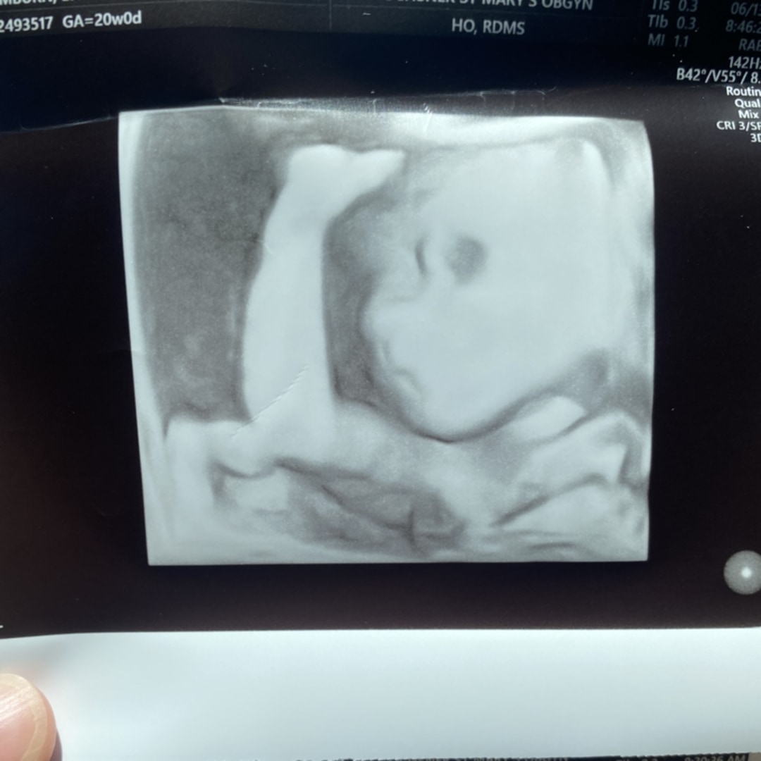 Photo shared by Bayley for their Babylist baby registry.