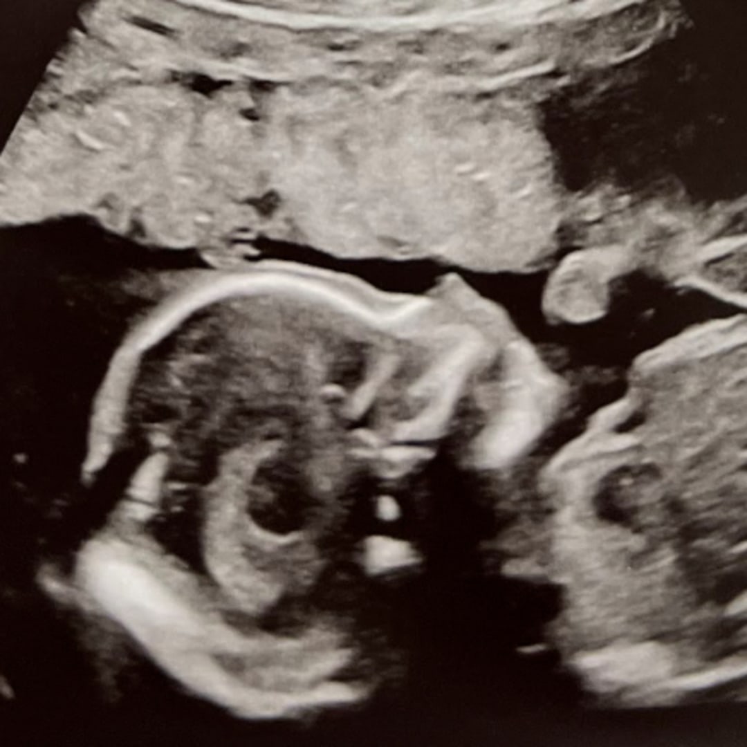 Photo shared by Jenna for their Babylist baby registry.