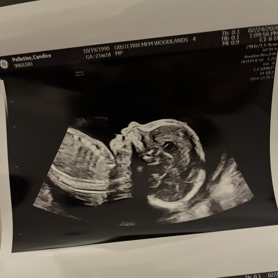 Photo shared by Candice Autumn for their Babylist baby registry.