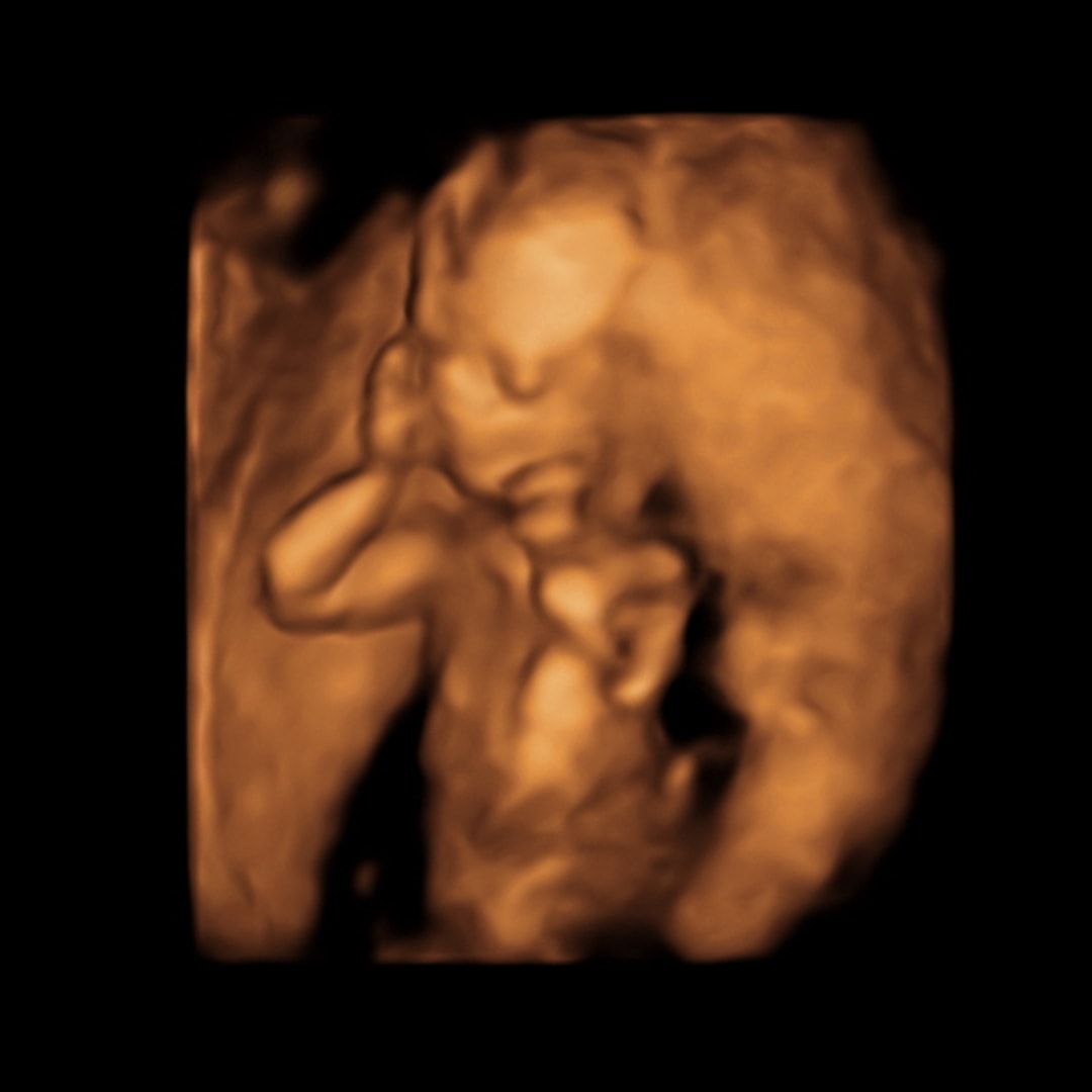 Photo shared by Emily for their Babylist baby registry.