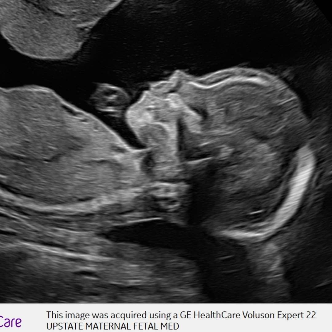 Photo shared by Heather for their Babylist baby registry.