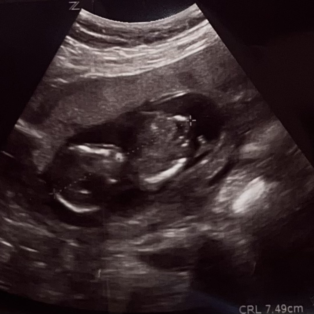 Photo shared by Michelle for their Babylist baby registry.