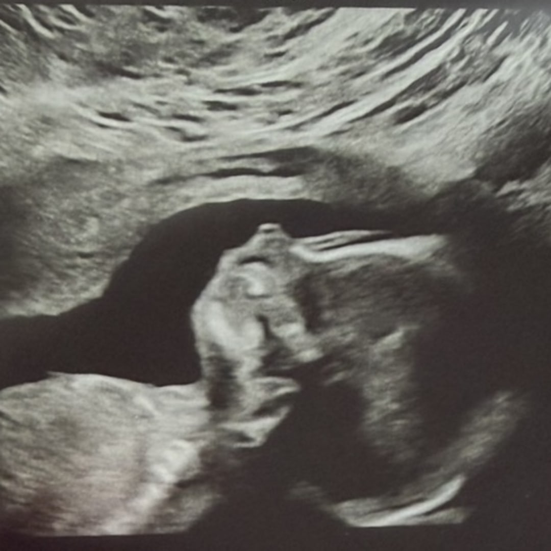 Photo shared by Kaitlyn for their Babylist baby registry.