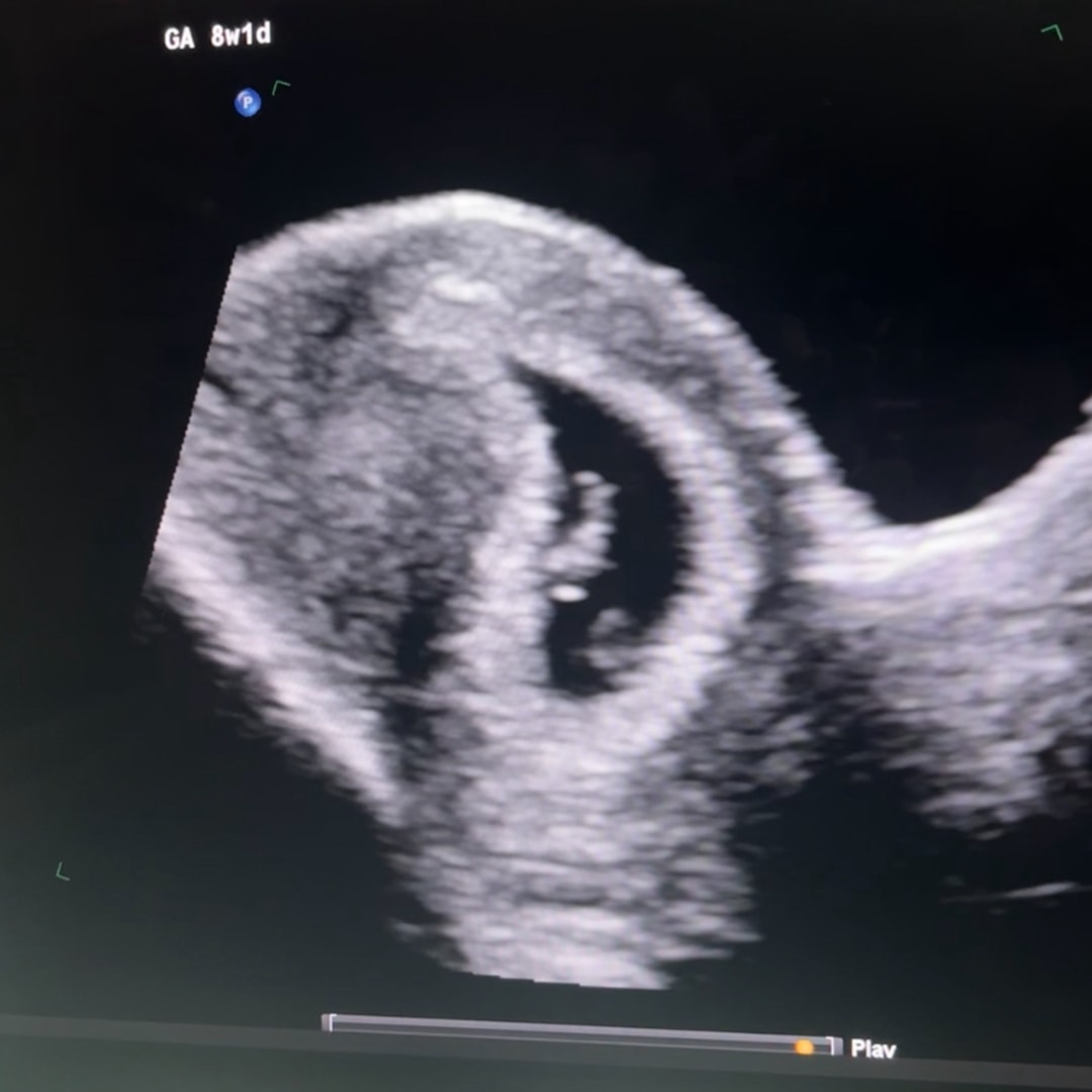 Photo shared by Monica for their Babylist baby registry.