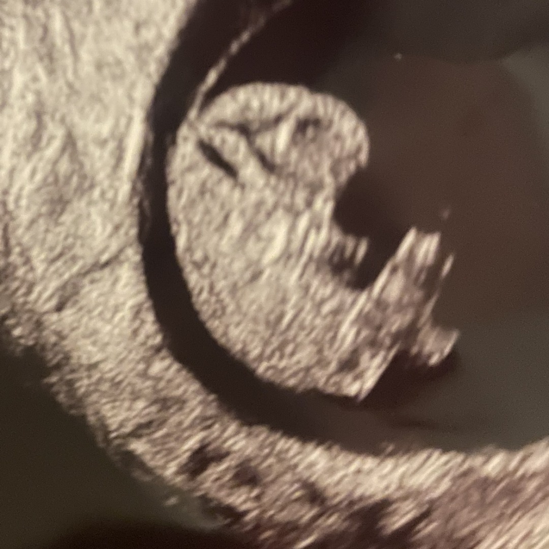 Photo shared by Haley for their Babylist baby registry.
