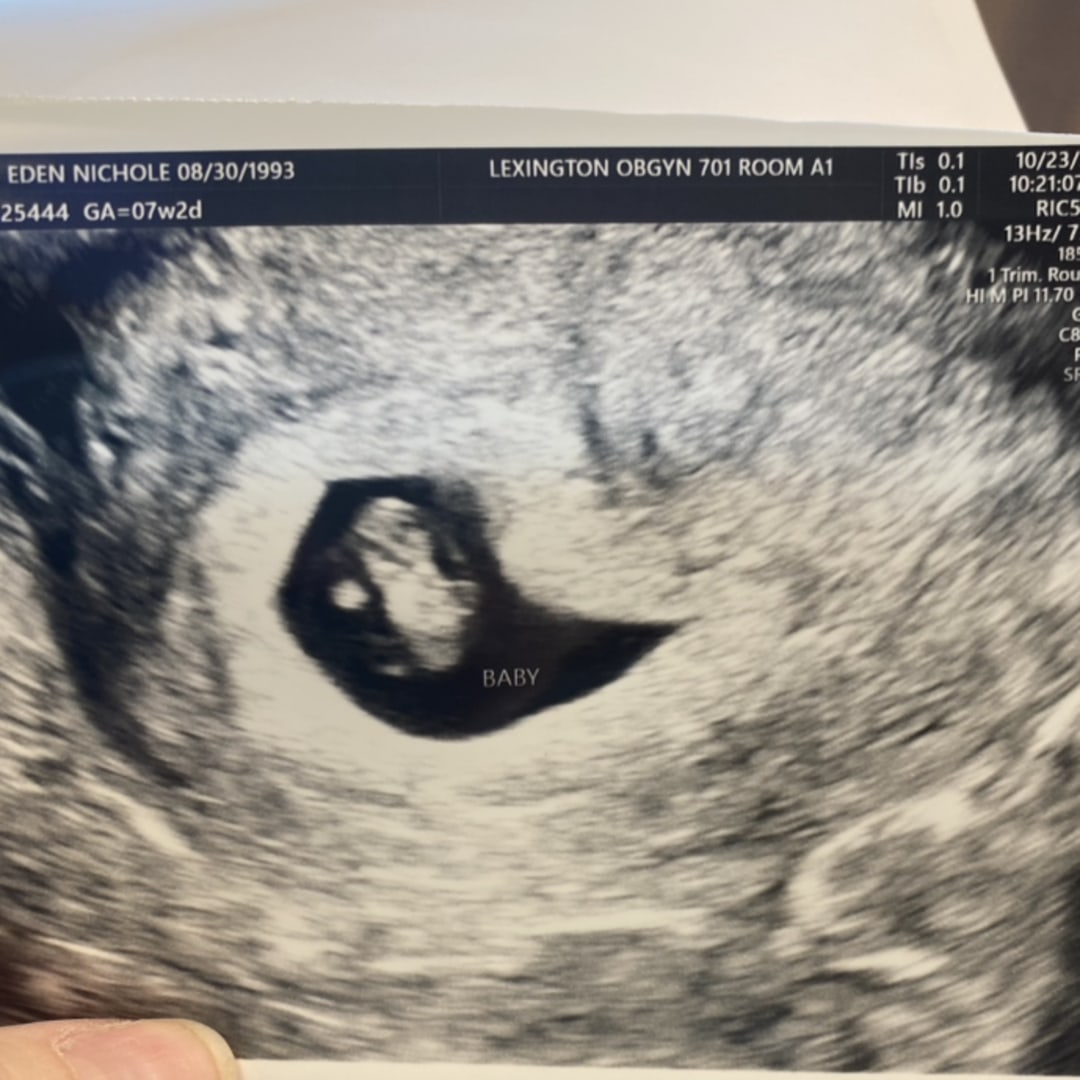 Photo shared by Eden for their Babylist baby registry.