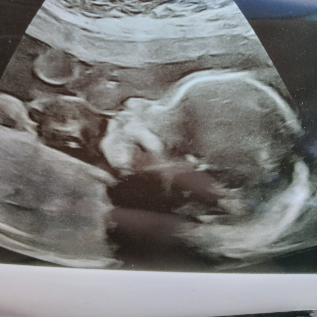 Photo shared by Alayah for their Babylist baby registry.