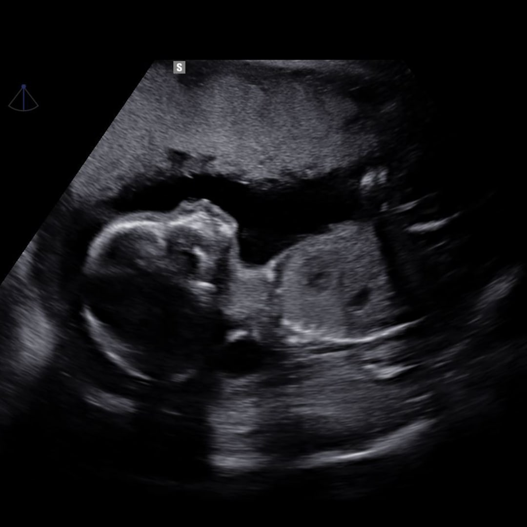 Photo shared by Katie for their Babylist baby registry.