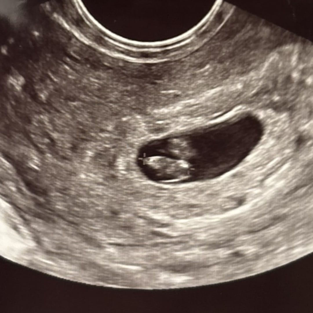 Photo shared by Kimeiko for their Babylist baby registry.