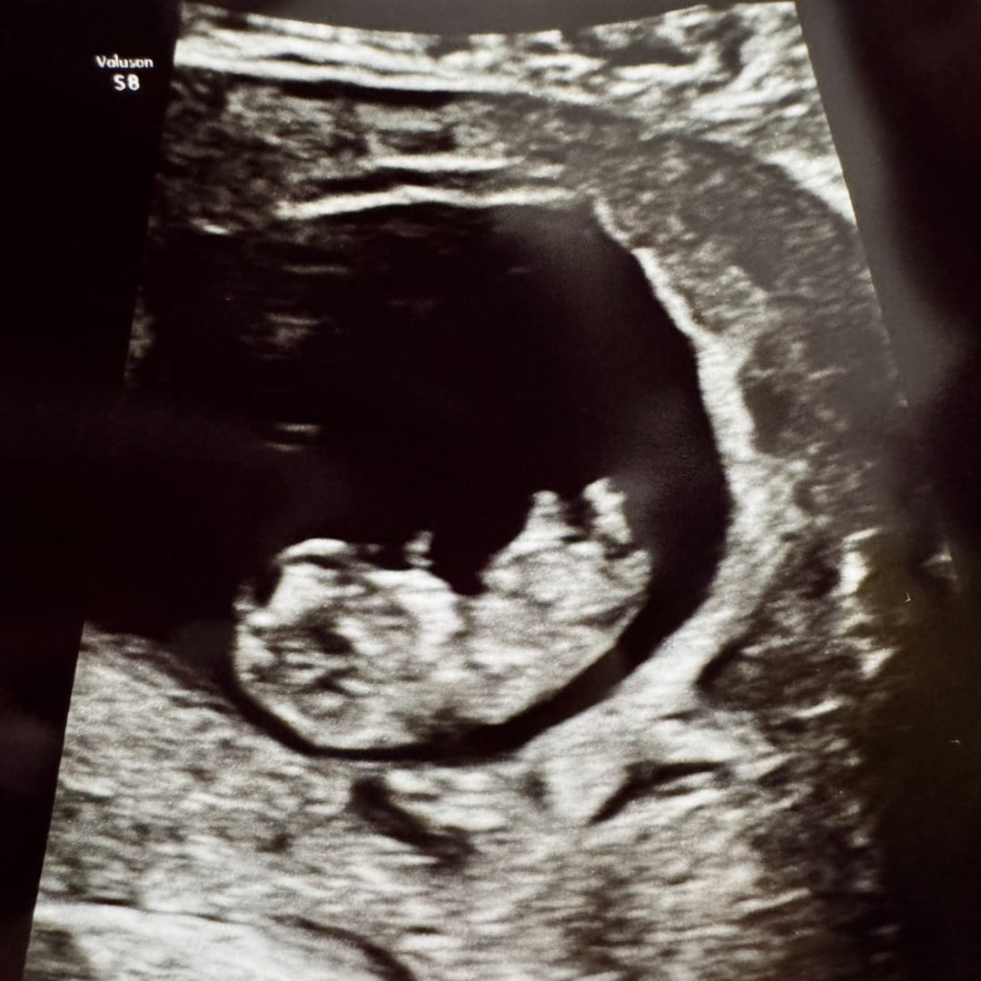 Photo shared by Beatrice for their Babylist baby registry.