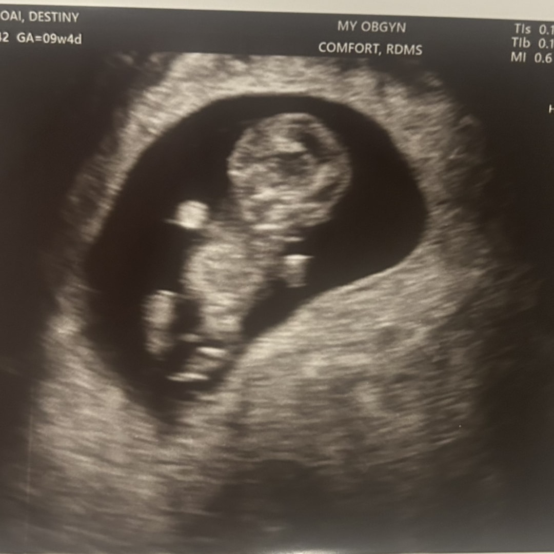 Photo shared by Destiny for their Babylist baby registry.