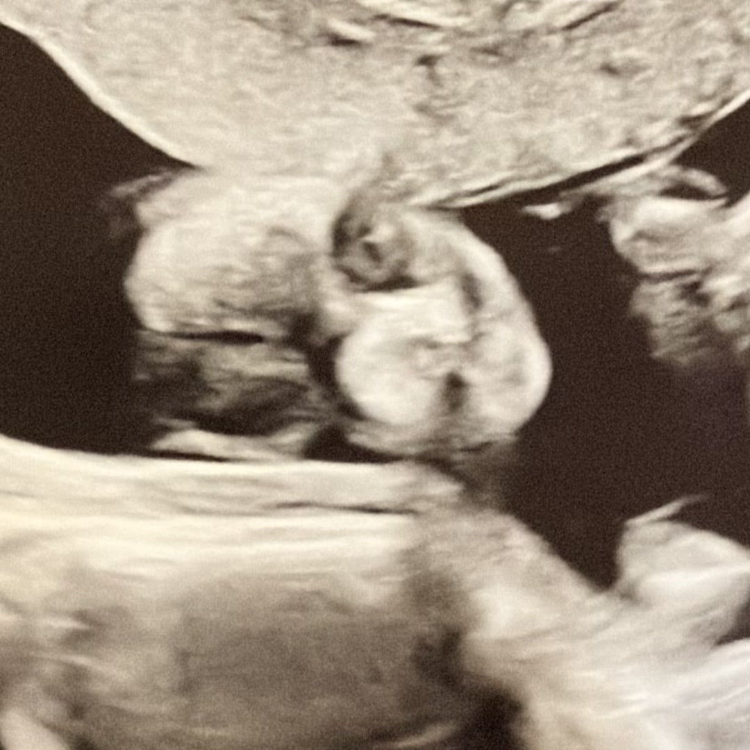 Photo shared by Aujanae for their Babylist baby registry.