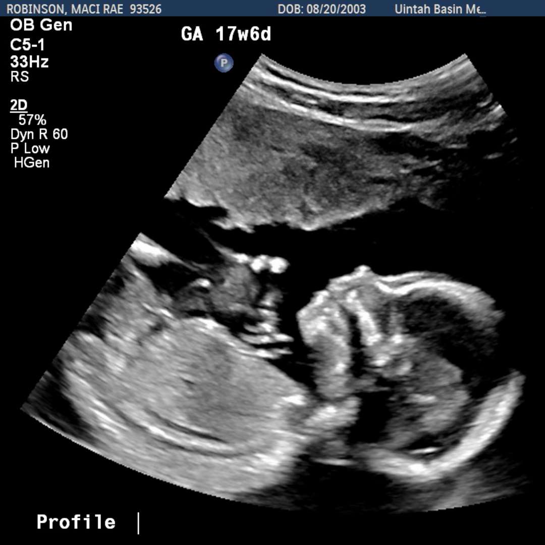 Photo shared by Maci for their Babylist baby registry.