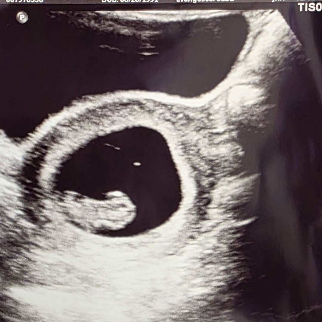 Photo shared by Chanel for their Babylist baby registry.