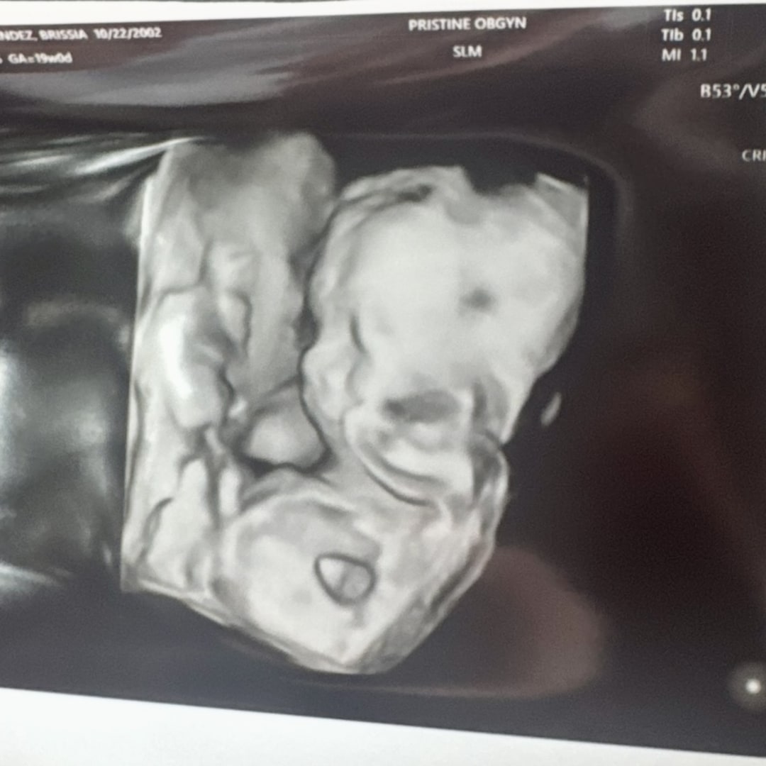 Photo shared by Brissia for their Babylist baby registry.