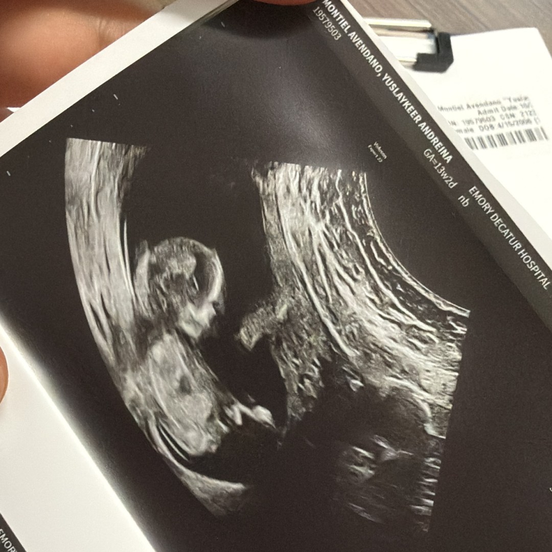 Photo shared by Yuslaykeer for their Babylist baby registry.