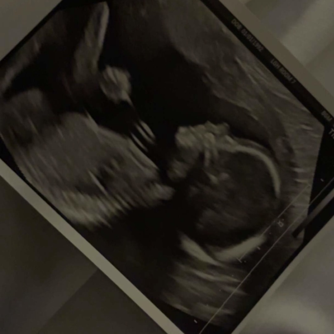 Photo shared by Jillian for their Babylist baby registry.