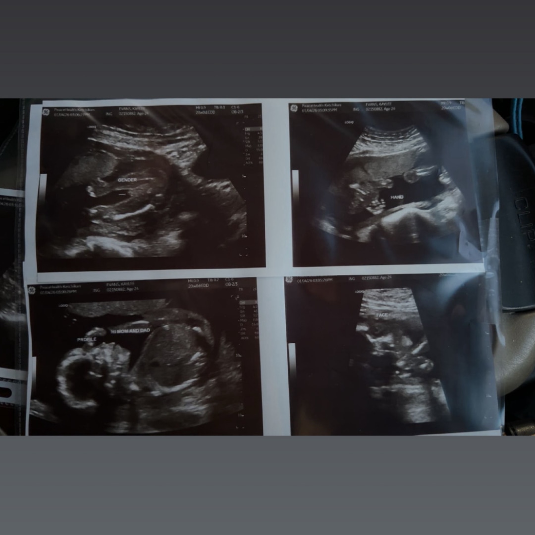 Photo shared by Kaylee for their Babylist baby registry.