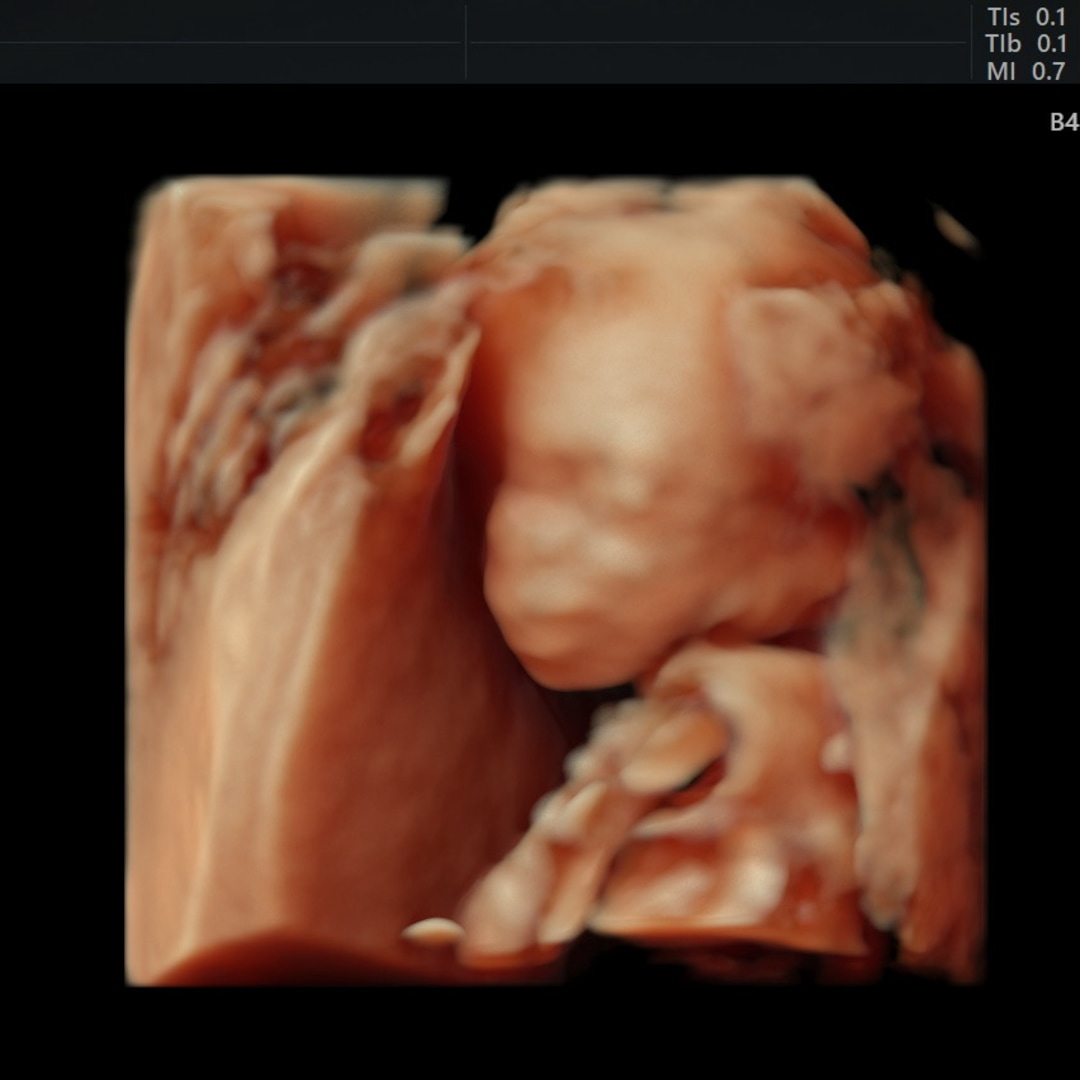 Photo shared by Mariah for their Babylist baby registry.