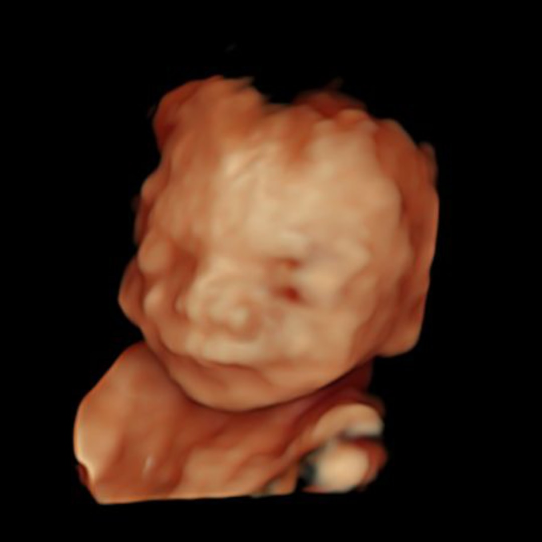 Photo shared by Amanda for their Babylist baby registry.