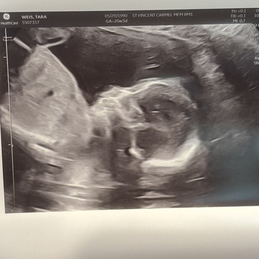 Photo shared by Tara for their Babylist baby registry.