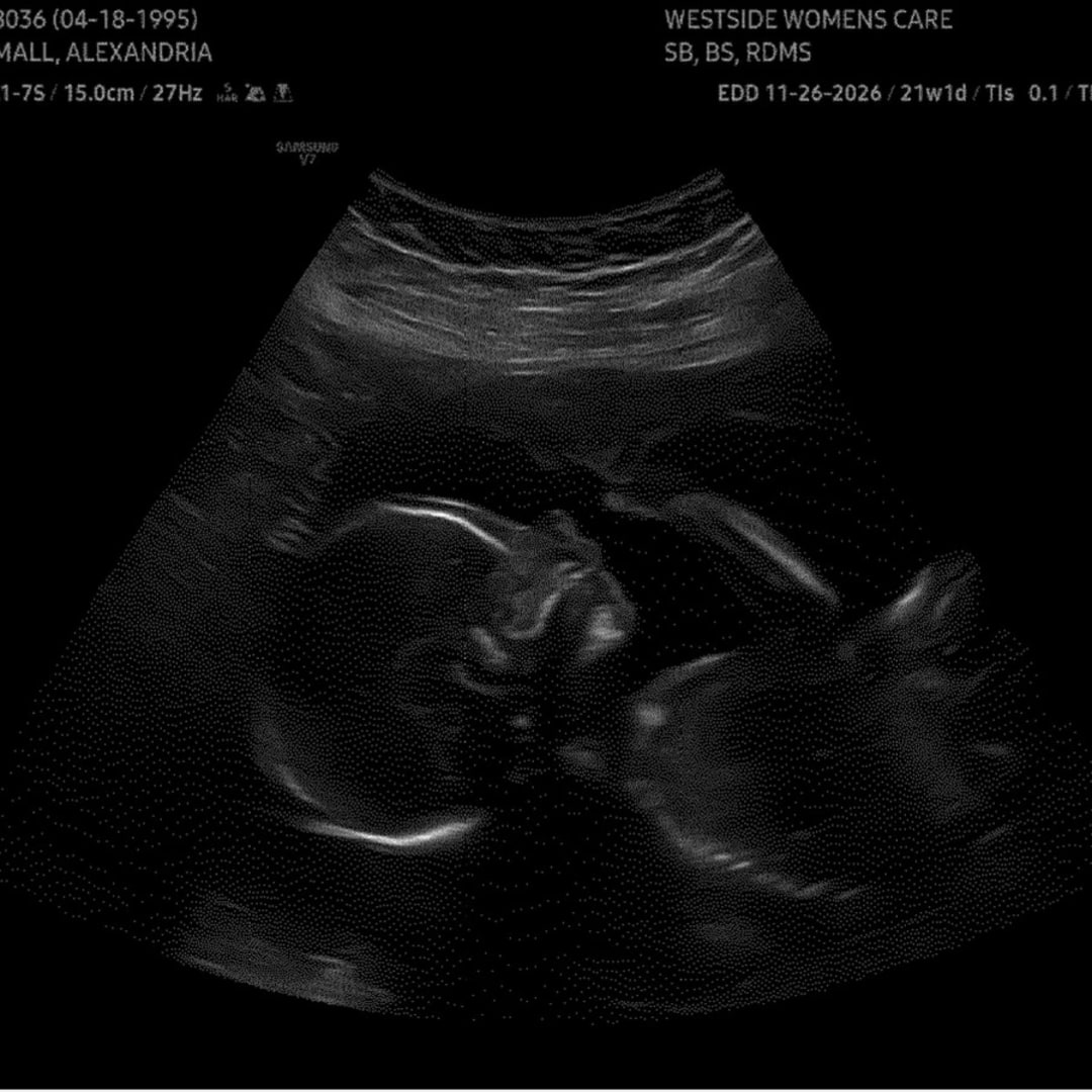 Photo shared by Allie for their Babylist baby registry.