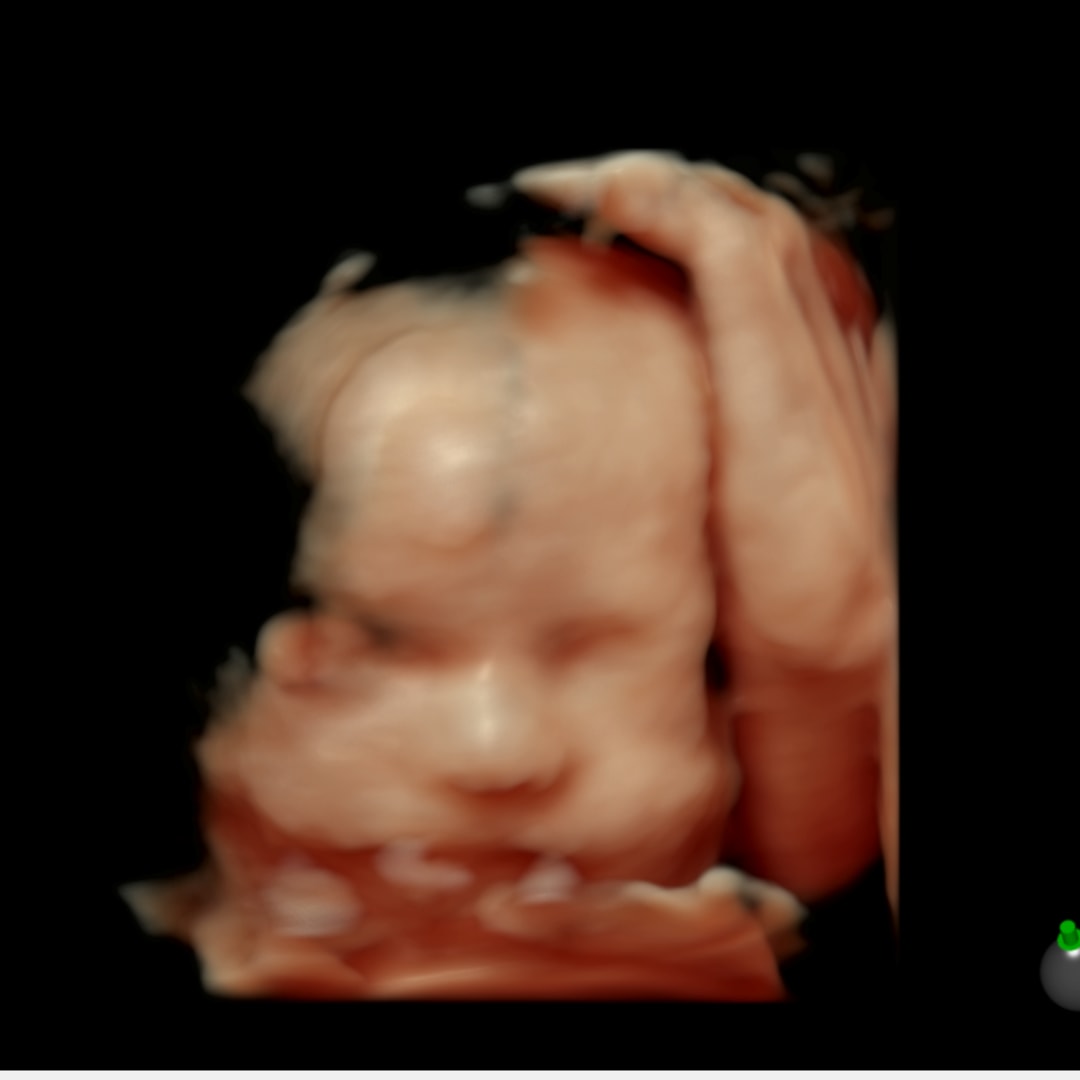 Photo shared by Isabella for their Babylist baby registry.