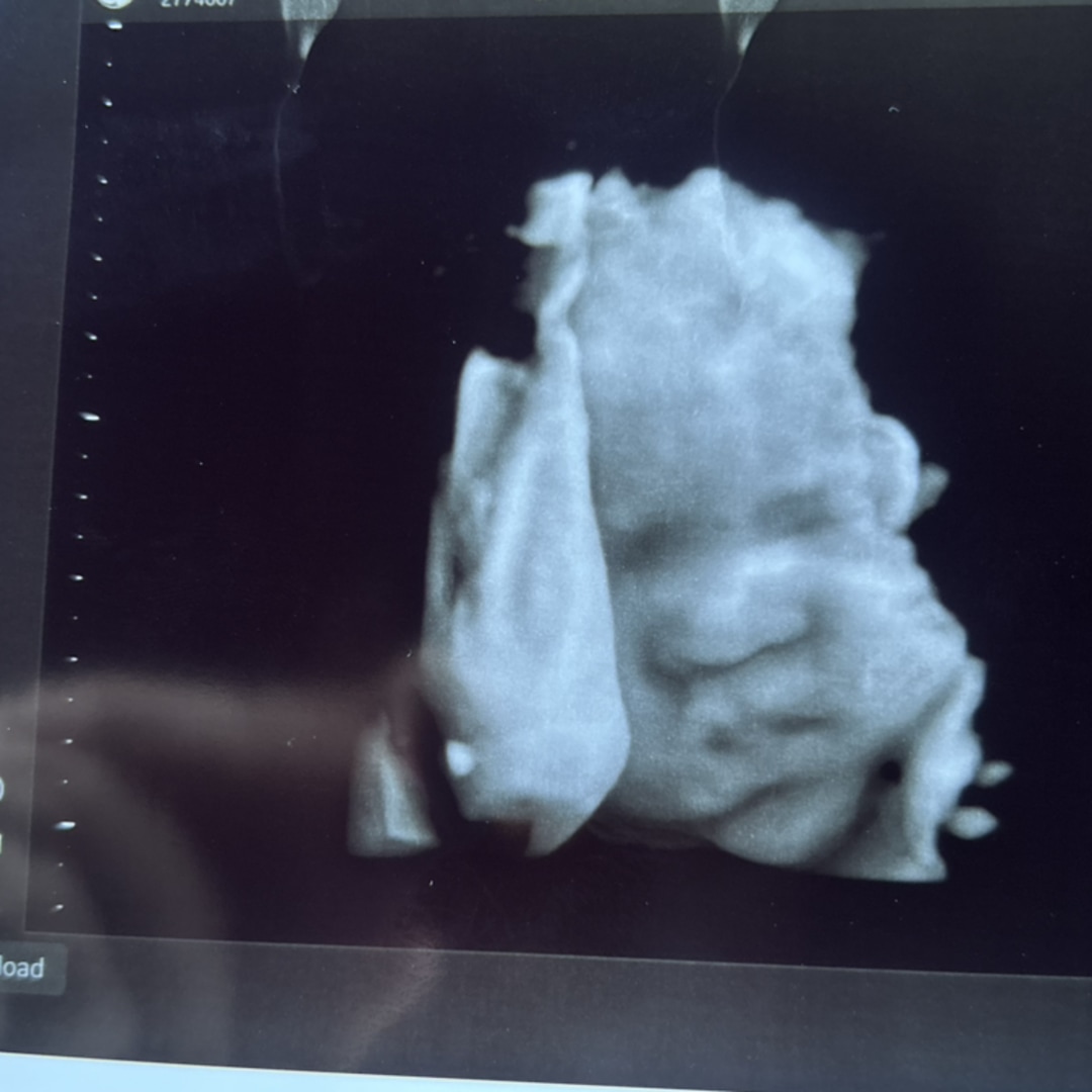 Photo shared by Emily for their Babylist baby registry.