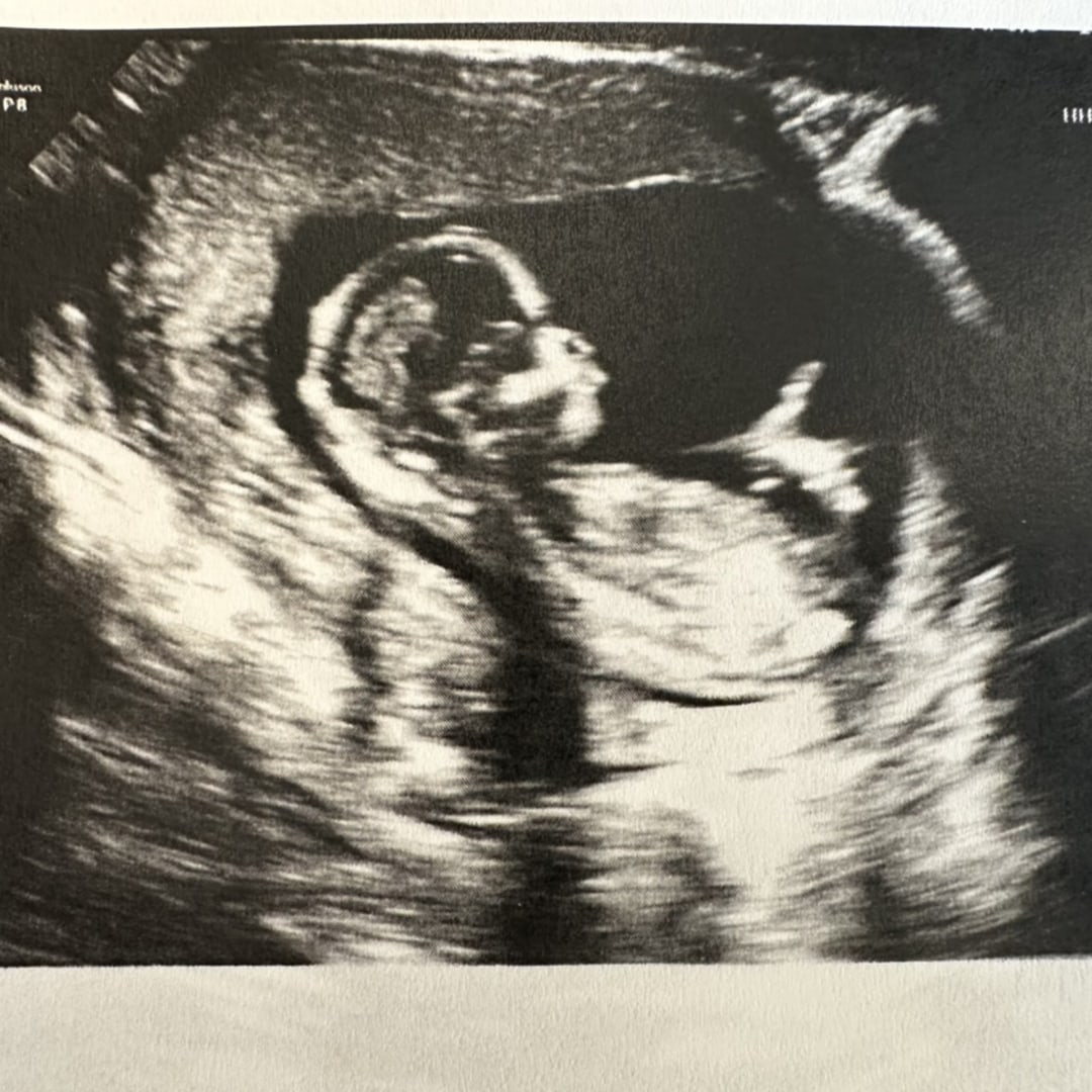 Photo shared by Kristin for their Babylist baby registry.