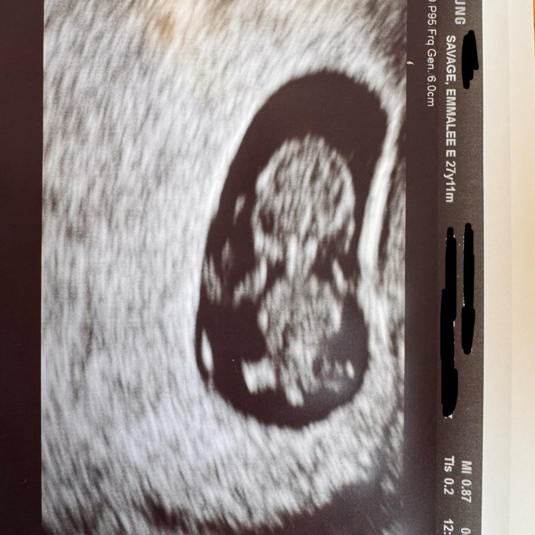 Photo shared by Emmalee for their Babylist baby registry.