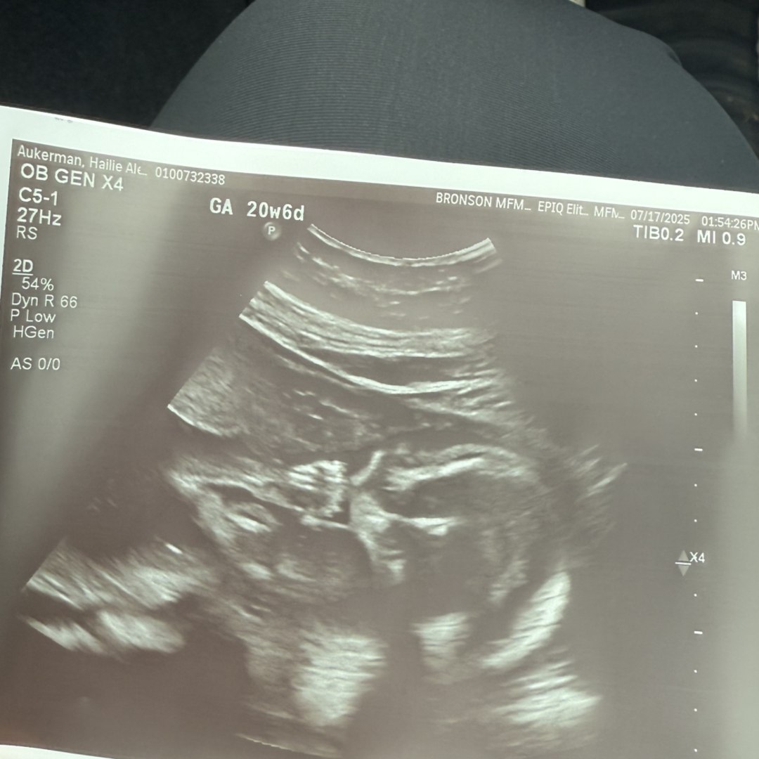 Photo shared by Hailie for their Babylist baby registry.
