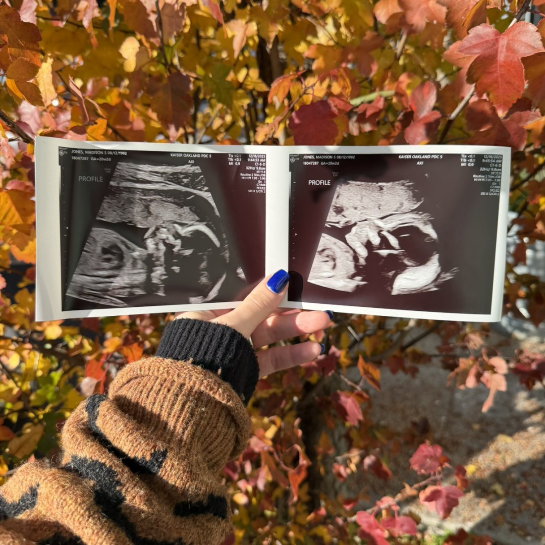 Photo shared by Madison for their Babylist baby registry.