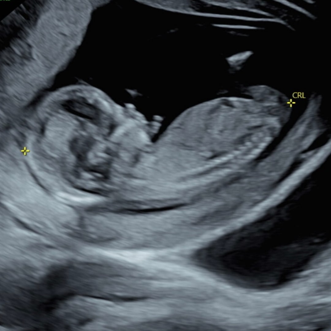Photo shared by Ursulla for their Babylist baby registry.
