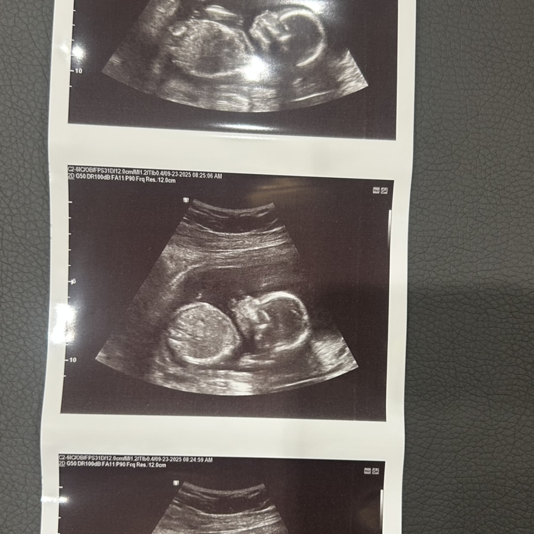 Photo shared by Shelbie for their Babylist baby registry.