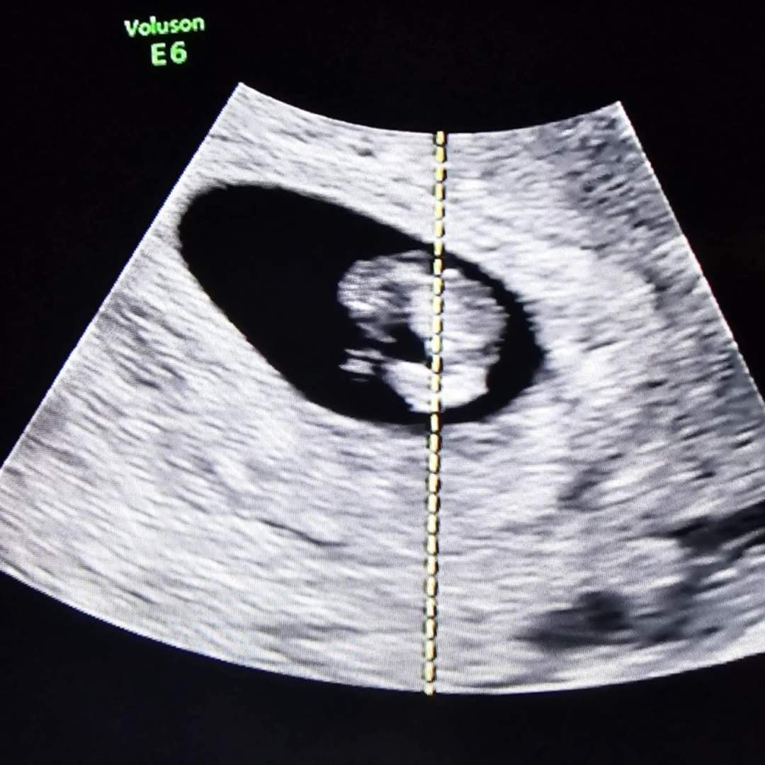 Photo shared by Elizabeth for their Babylist baby registry.