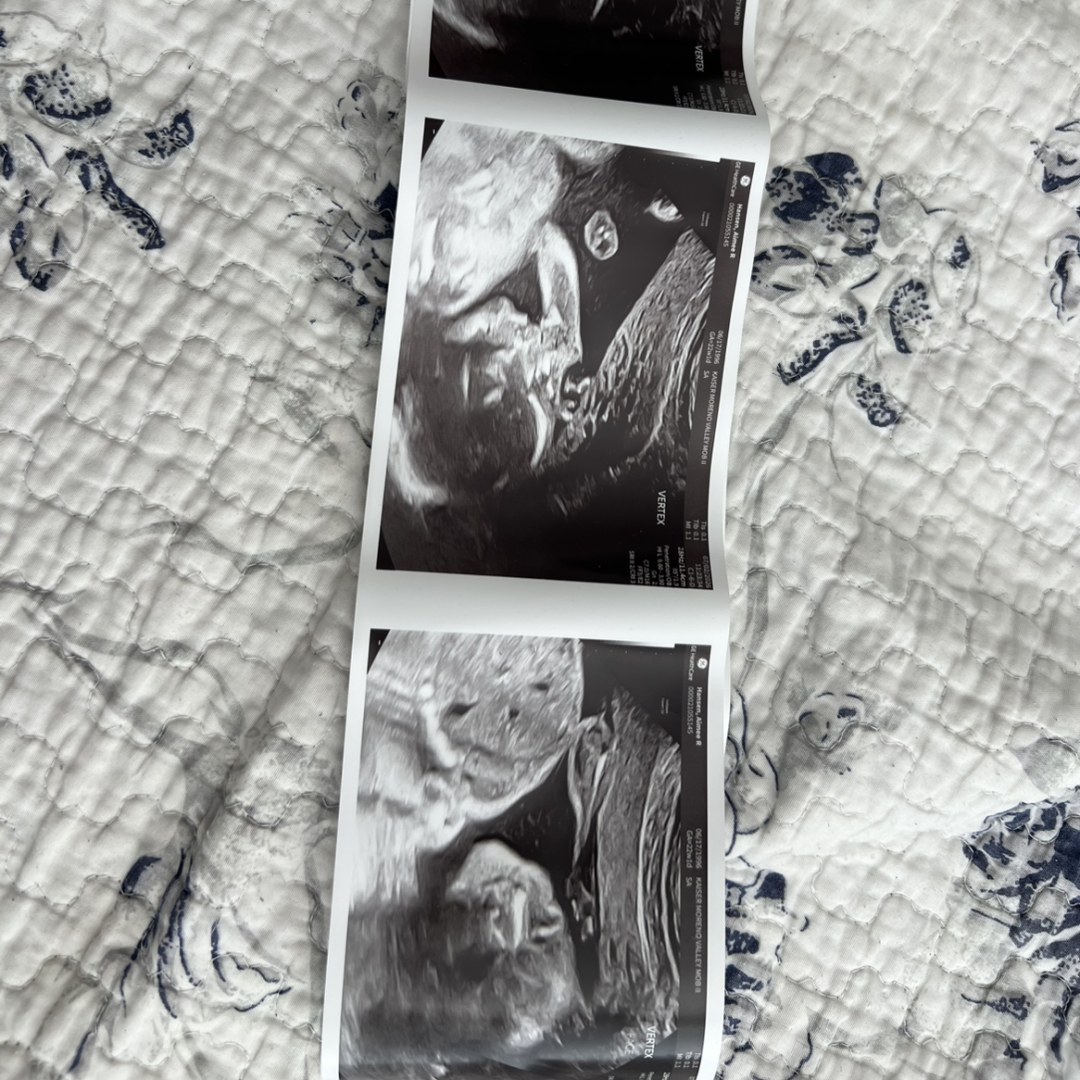 Photo shared by Aimee for their Babylist baby registry.