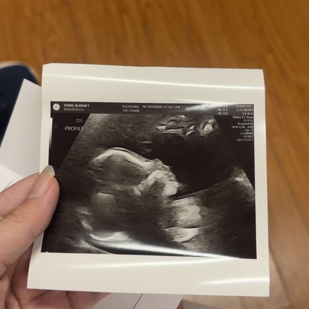 Photo shared by Alison for their Babylist baby registry.