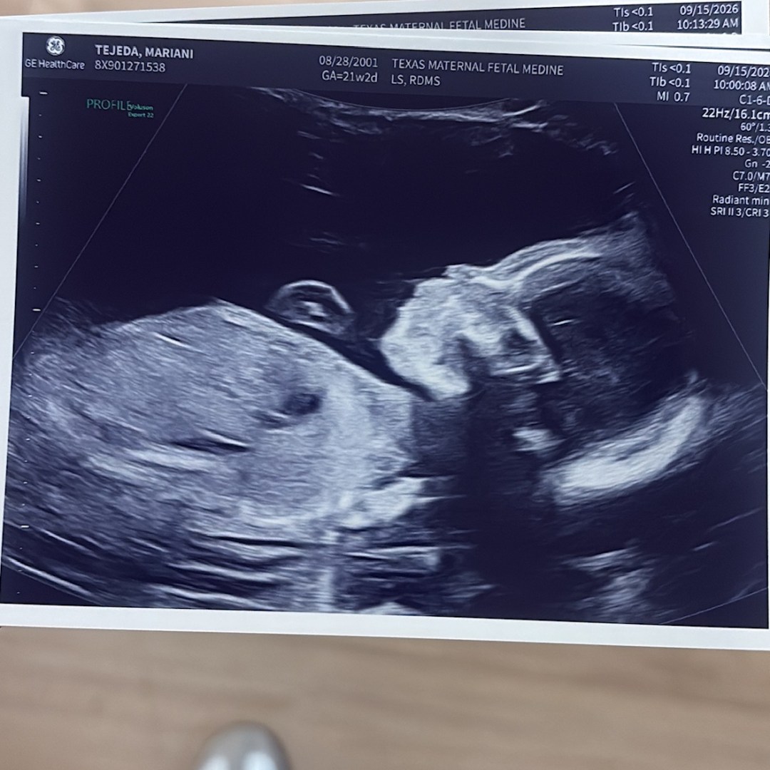 Photo shared by Mariani for their Babylist baby registry.