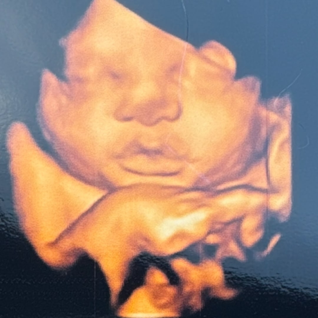 Photo shared by Jazzmin for their Babylist baby registry.